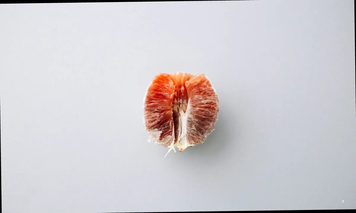 IgA 신증, 만성 신부전으로 진행될 가능성이 있다구요?